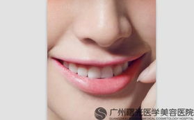 濟南隆鼻修復的注意事項有哪些