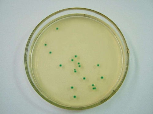 細(xì)胞復(fù)蘇的注意事項(xiàng),細(xì)胞復(fù)蘇的操作步驟和注意事項(xiàng),細(xì)胞傳代的步驟和注意事項(xiàng)