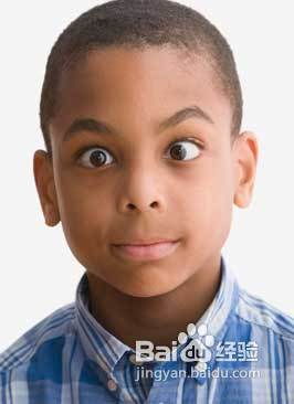 斜視配鏡需注意事項