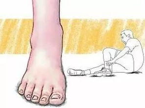 手拉扭傷注意事項