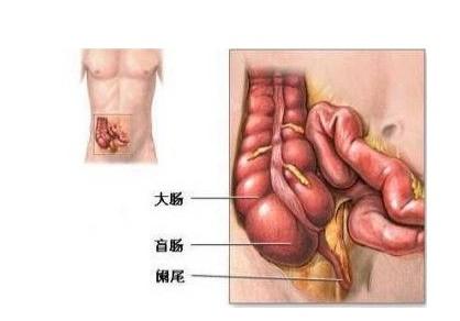 闌尾炎微創(chuàng)手術(shù)后注意事項,闌尾炎吊水好了以后注意事項,闌尾炎手術(shù)后注意事項和飲食