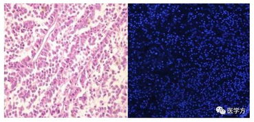 石蠟,制片,注意事項