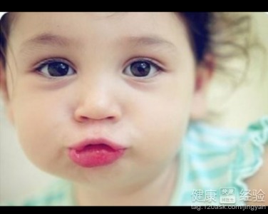 慢性結(jié)膜要注意事項(xiàng)