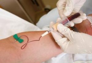 采血,靜脈,注意事項,技術