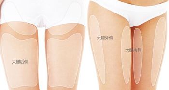 大腿內(nèi)側(cè)抽脂注意事項(xiàng)