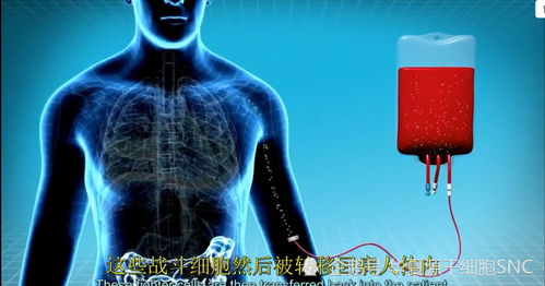 免疫細(xì)胞回輸注意事項(xiàng)