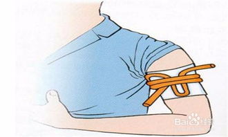 止血帶,應(yīng)注意,事項(xiàng)