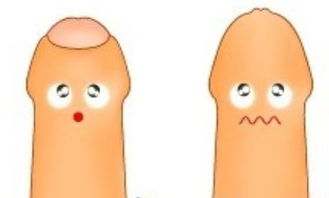 包皮,手術(shù)后,注意事項(xiàng),小孩