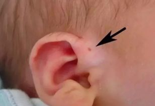 洗完耳朵注意事項(xiàng)