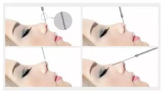 眼袋,注意事項(xiàng)