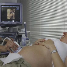 女人備孕注意事項,孕檢b超注意事項,孕6周b超注意事項