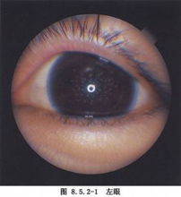 目的,結(jié)膜,注射,注意事項