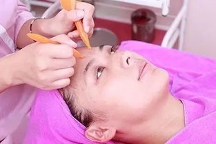 面部拔筋注意事項