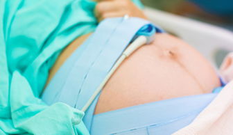 刨腹產(chǎn)護理注意事項