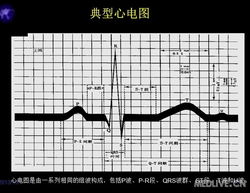 心電圖基礎(chǔ)知識(shí)講解,心電圖教學(xué)基礎(chǔ)知識(shí),心電圖入門基礎(chǔ)知識(shí)