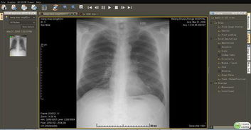 醫(yī)學(xué)影像基礎(chǔ)概論前五章知識點
